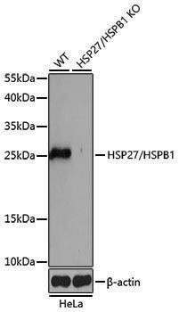 [KO Validated] Anti-HSP27 Rabbit pAb