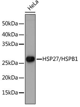 [KO Validated] Anti-HSP27 Rabbit pAb