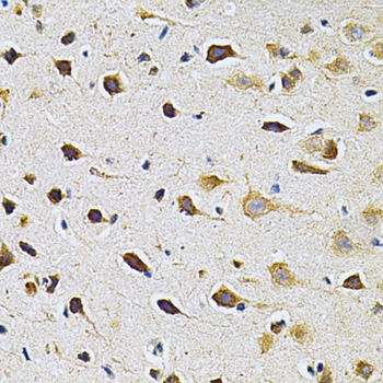 [KO Validated] Anti-GRK2 Rabbit pAb