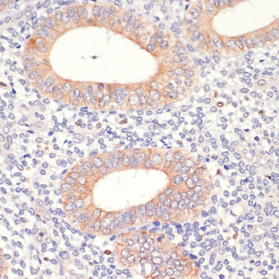 Anti-HMGCR Rabbit pAb