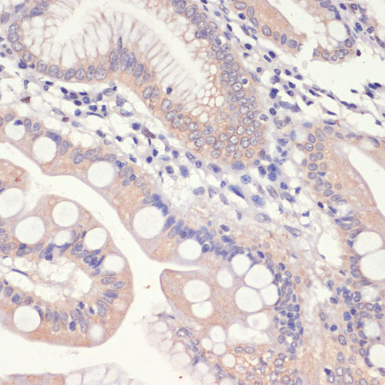 Anti-HMGCR Rabbit pAb