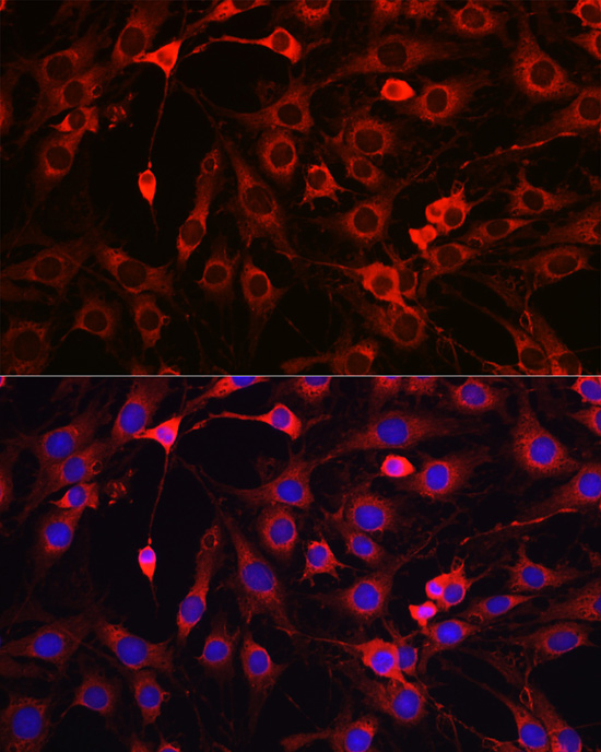 Anti-HMGCR Rabbit pAb