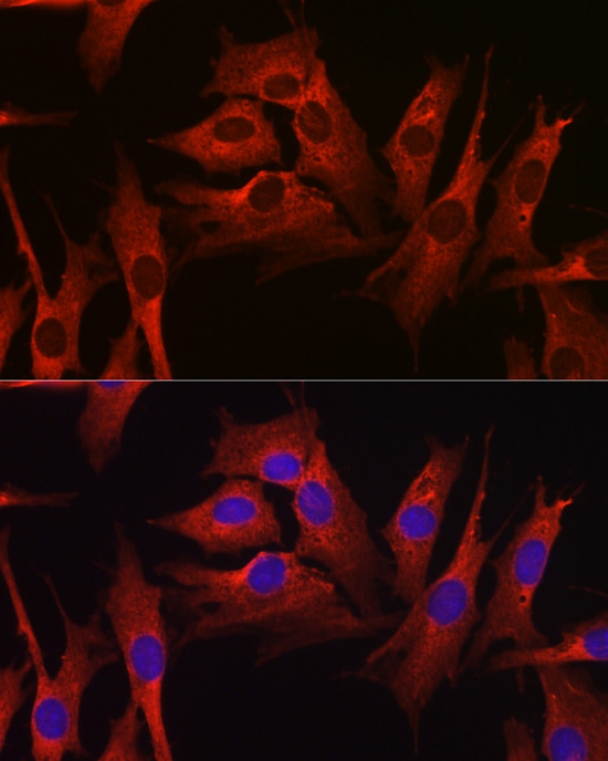 Anti-HMGCR Rabbit pAb