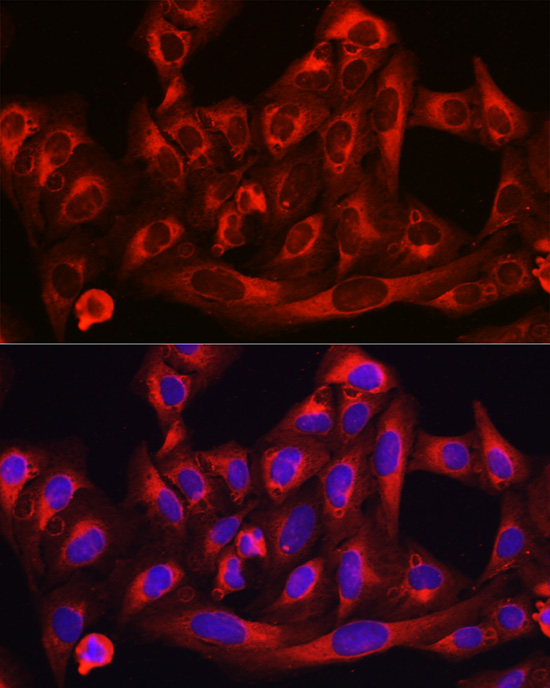 Anti-HMGCR Rabbit pAb
