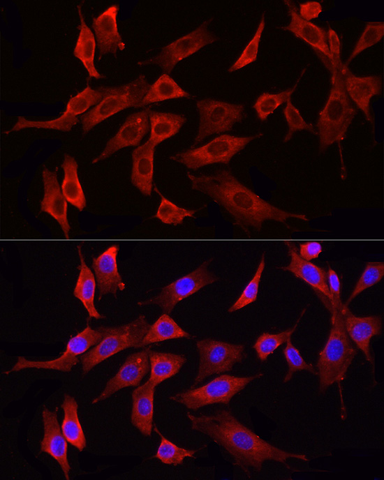 Anti-HMGCR Rabbit pAb