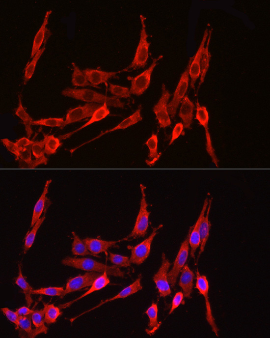 Anti-HMGCR Rabbit pAb