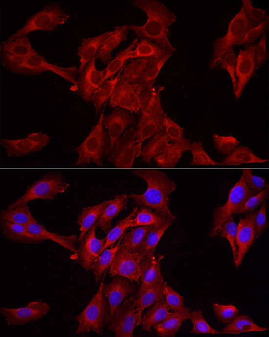 Anti-HMGCR Rabbit pAb