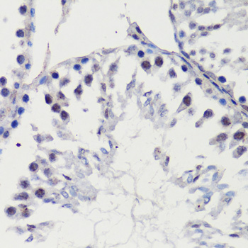 Anti-p27 Kip 1 Rabbit pAb