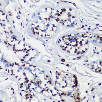 Anti-p27 Kip 1 Rabbit pAb