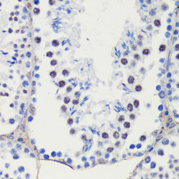 Anti-p27 Kip 1 Rabbit pAb