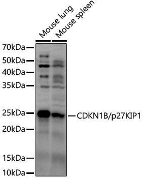 Anti-p27 Kip 1 Rabbit pAb