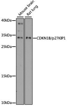 Anti-p27 Kip 1 Rabbit pAb