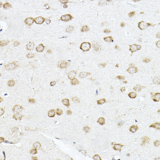Anti-SCD1 Rabbit pAb