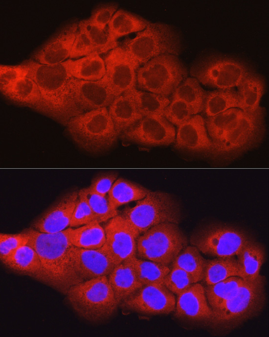 Anti-SCD1 Rabbit pAb
