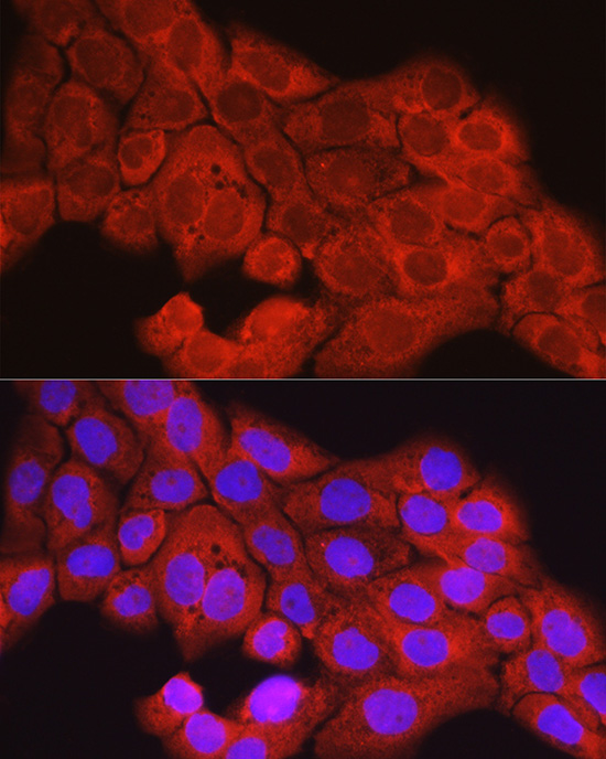 Anti-SCD1 Rabbit pAb