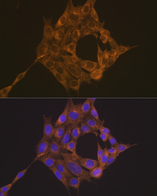 Anti-TRAF6 Rabbit pAb