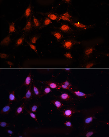 Anti-CTBP2 Rabbit pAb