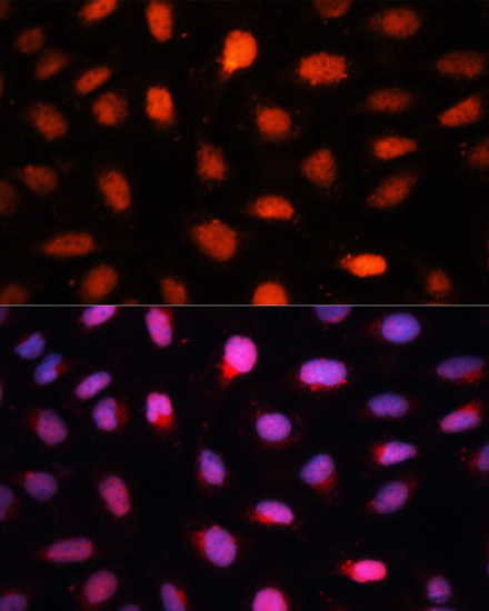 Anti-CTBP2 Rabbit pAb