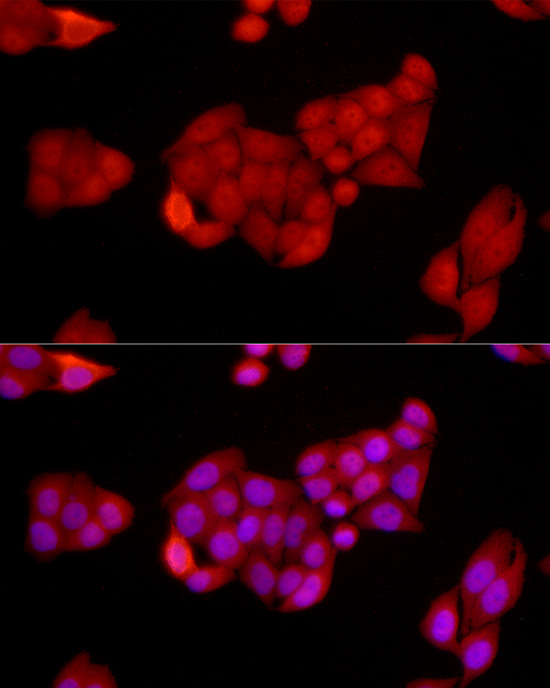 [KO Validated] Anti-SIRT1 Rabbit pAb