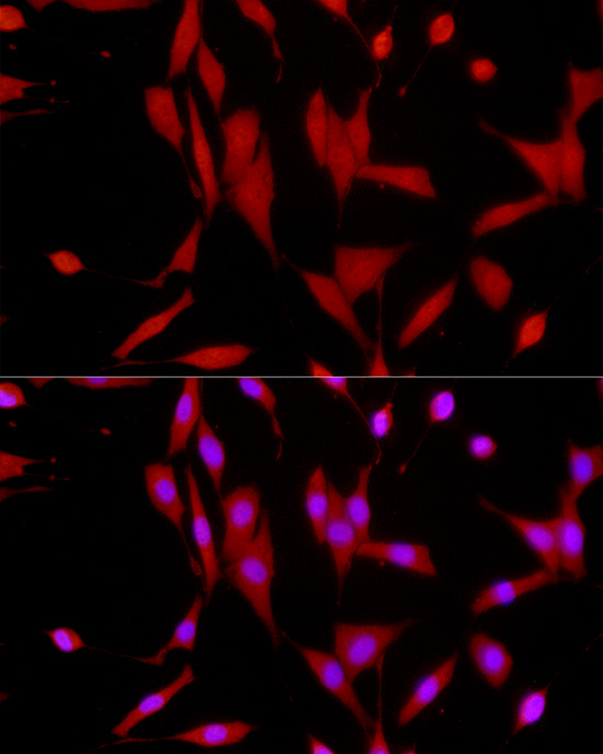 [KO Validated] Anti-SIRT1 Rabbit pAb