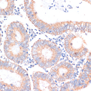 Anti-4E-BP1 Rabbit pAb