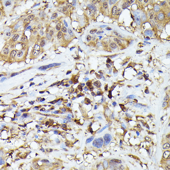 Anti-TMS1 Rabbit pAb