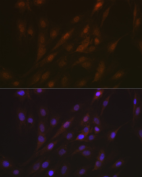 Anti-TMS1 Rabbit pAb