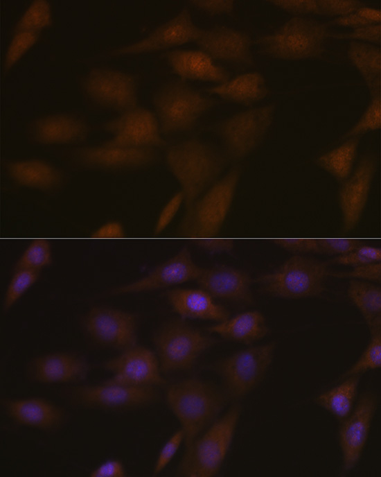 Anti-TMS1 Rabbit pAb