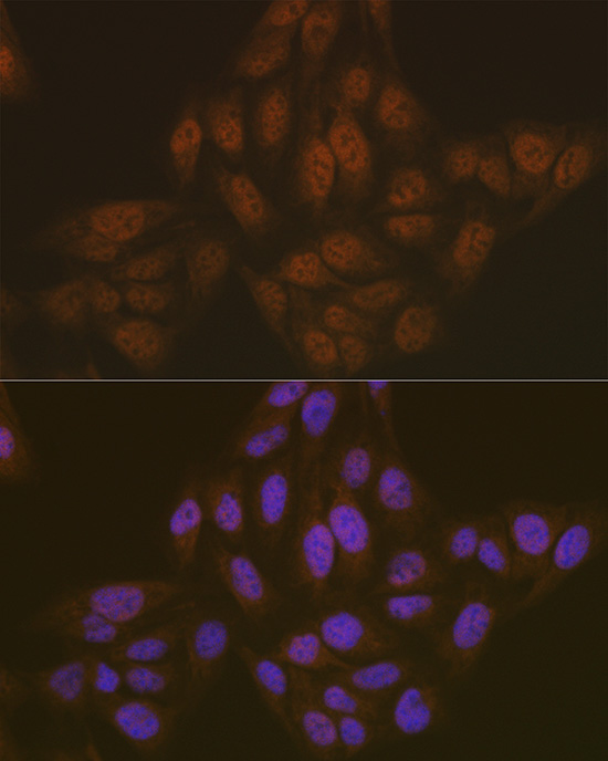 Anti-TMS1 Rabbit pAb