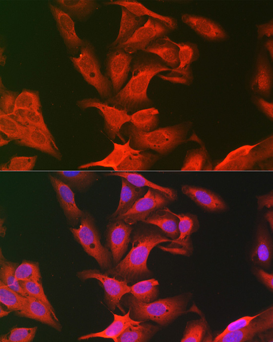 Anti-Keap1 Rabbit pAb