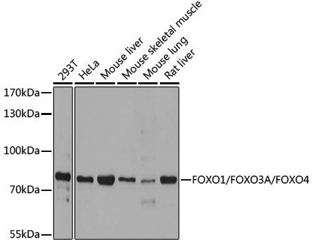 Anti-FOXO1/FOXO3A/FOXO4 Rabbit pAb