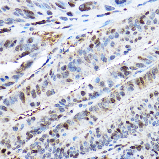 [KO Validated] Anti-CDK2 Rabbit pAb