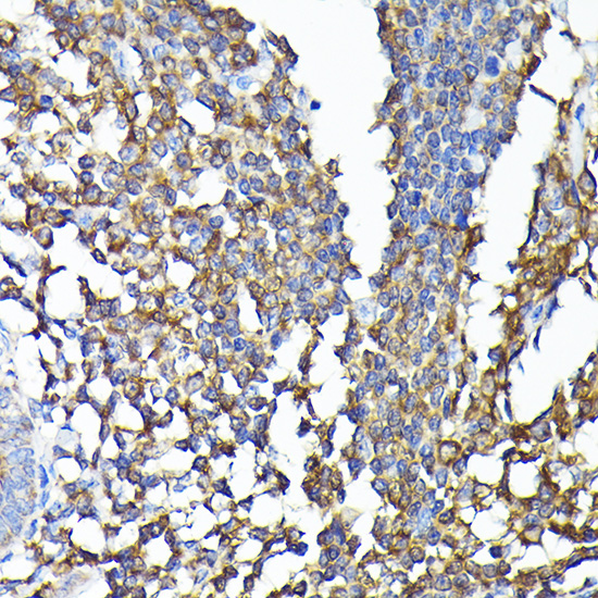 Anti-CSK Rabbit pAb