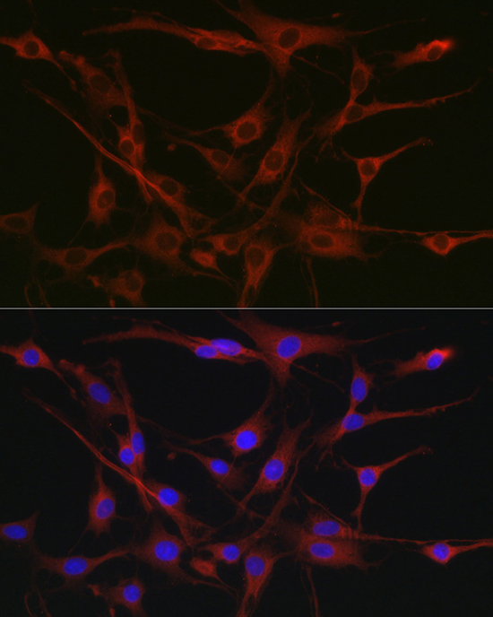 Anti-CSK Rabbit pAb