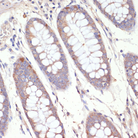 Anti-HMGCR Rabbit pAb