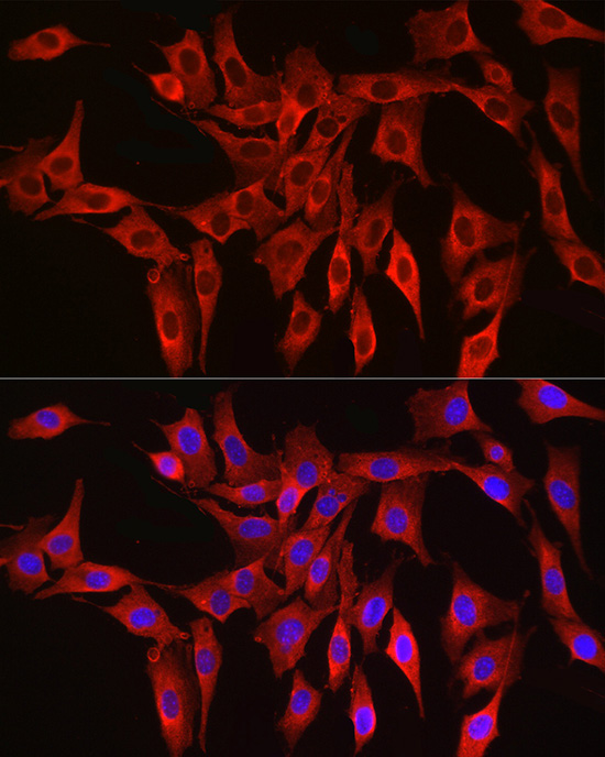 Anti-HMGCR Rabbit pAb