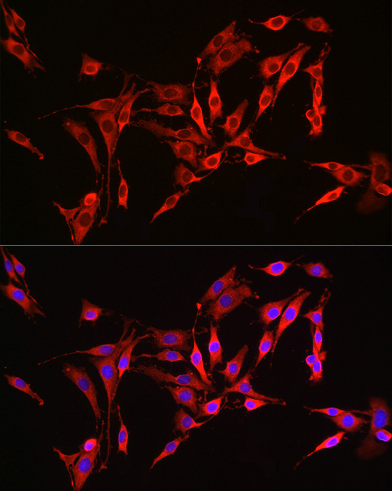 Anti-HMGCR Rabbit pAb