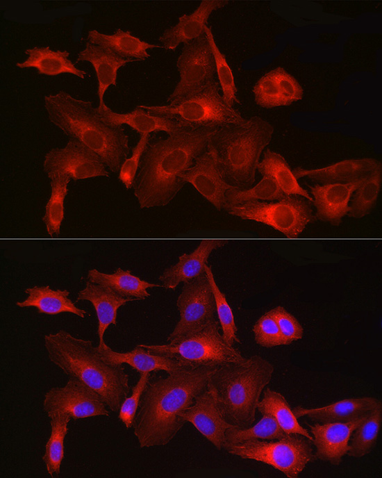 Anti-HMGCR Rabbit pAb