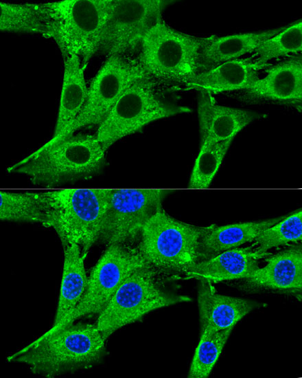 Anti-HMGCR Rabbit pAb