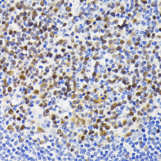 Anti-NFAT2 Rabbit pAb