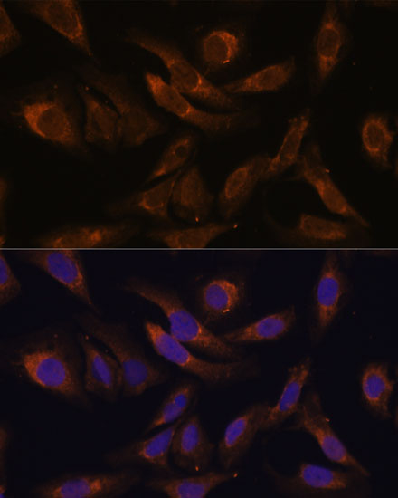 Anti-SOCS2 Rabbit pAb