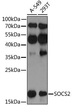 Anti-SOCS2 Rabbit pAb