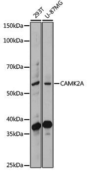 Anti-CaMK II alpha Rabbit pAb