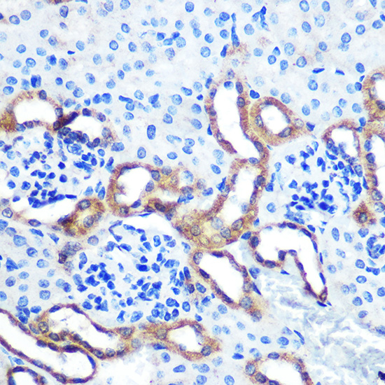 Anti-LRRK2 Rabbit pAb