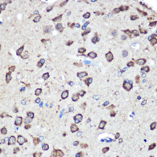 Anti-LRRK2 Rabbit pAb
