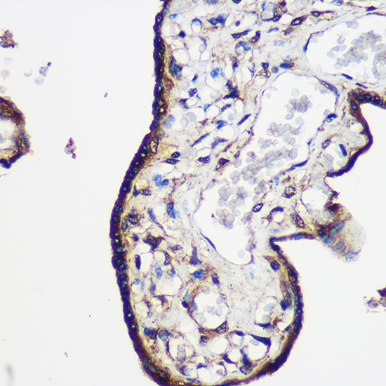 Anti-LRRK2 Rabbit pAb