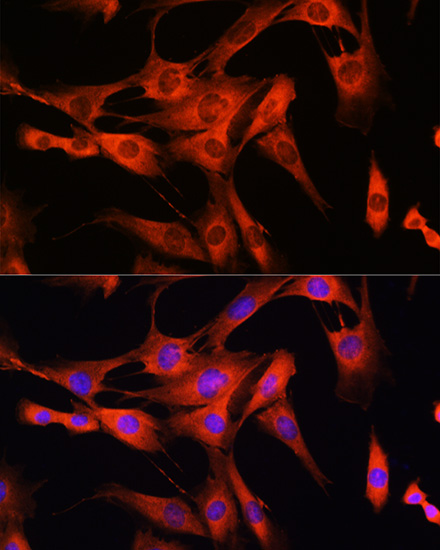 Anti-LRRK2 Rabbit pAb