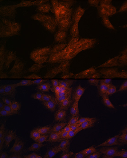 Anti-LRRK2 Rabbit pAb