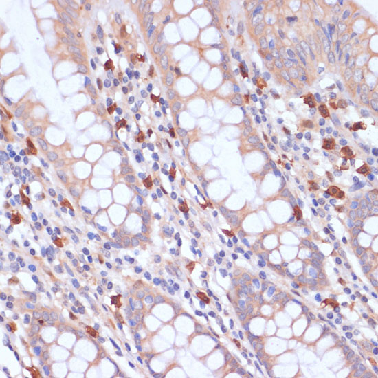 Anti-PI3 Kinase p85 beta Rabbit pAb