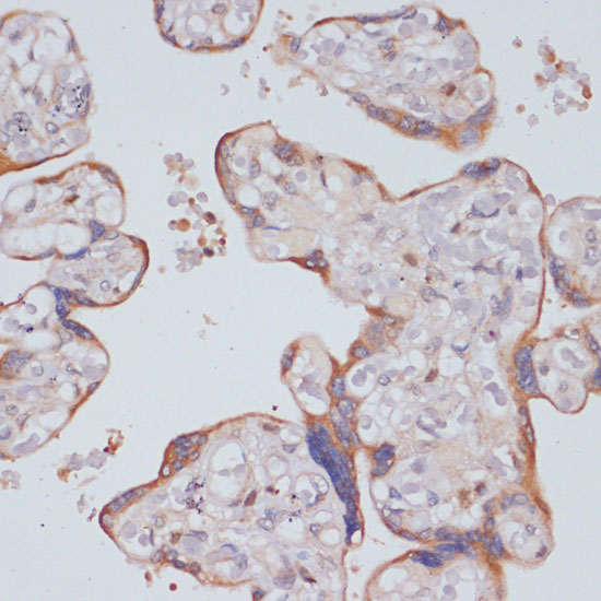Anti-PI3 Kinase p85 beta Rabbit pAb